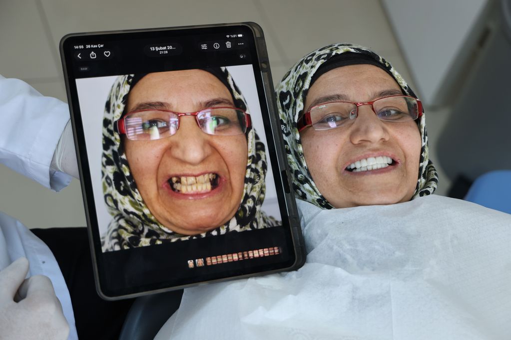 Diş tedavisinde implant yerine geçecek tedavi yöntemi