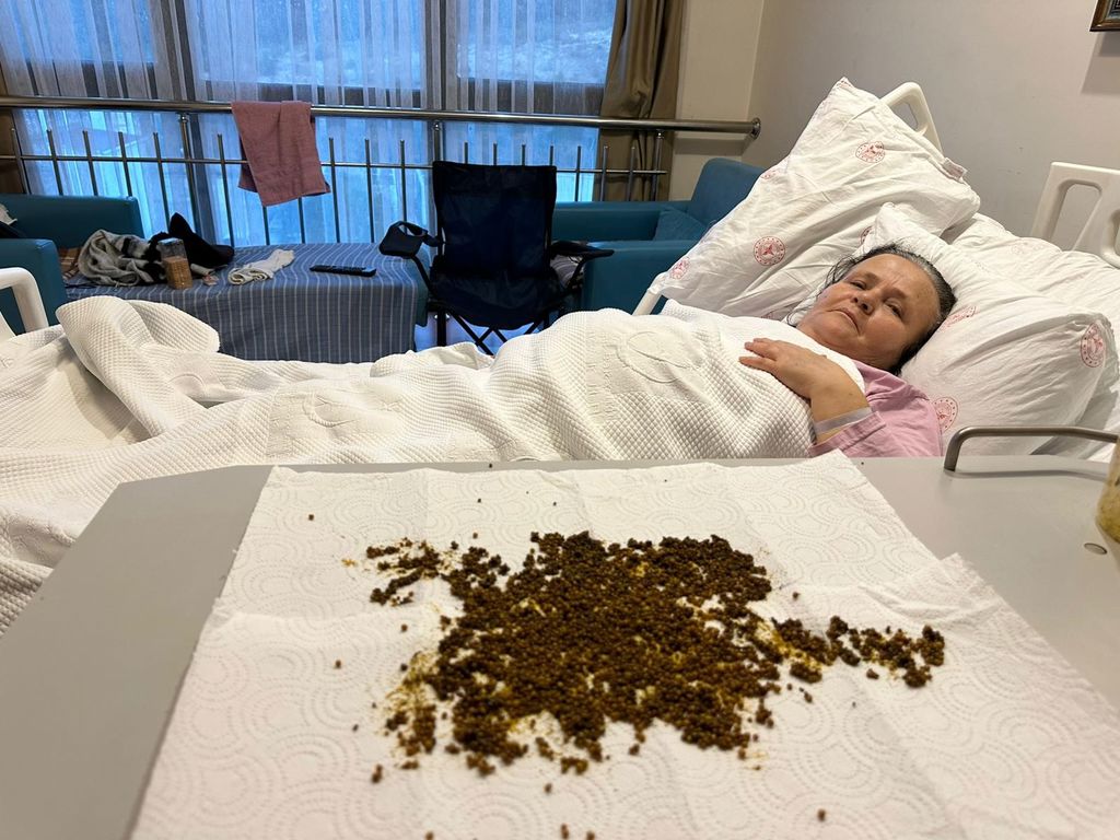 Hastadan çıkan taşları sayamadılar