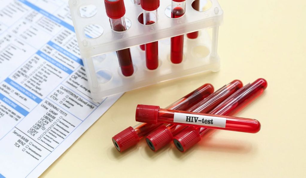 HIV belirtileri nelerdir? HIV olduğunuzu nasıl anlarsınız?
